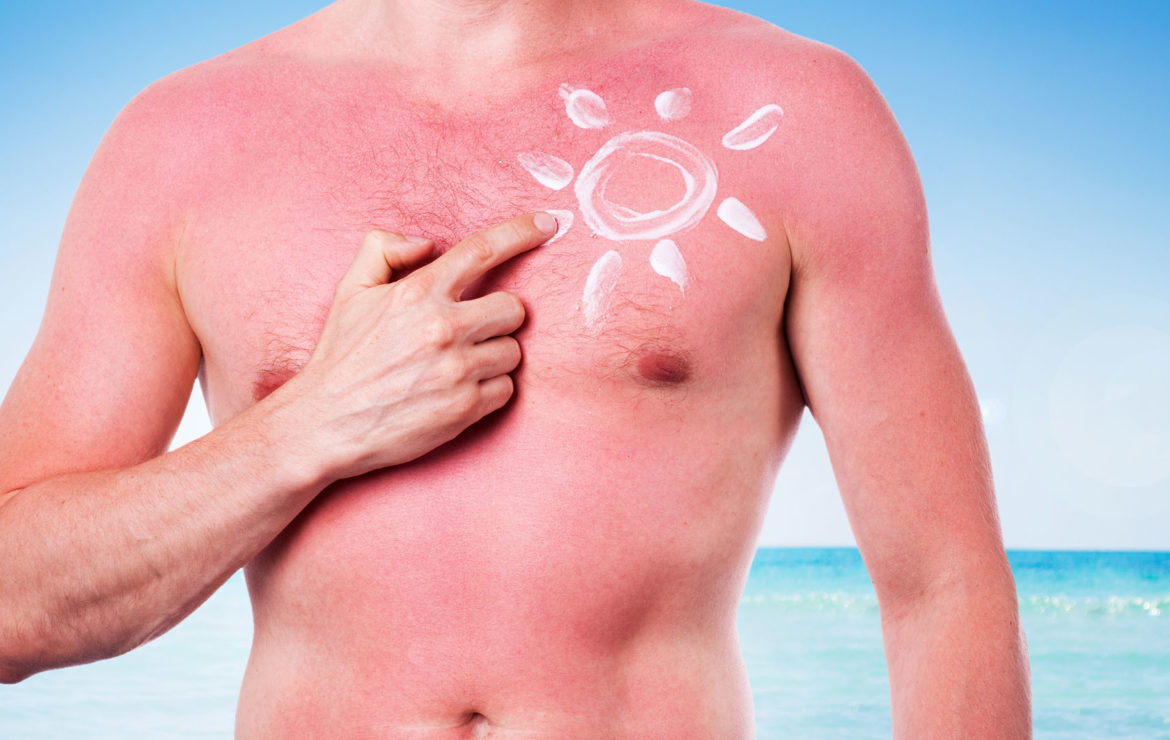 C’est l’été, il fait beau, chaud et les journées sont longues. Le soleil peut vite devenir l’ennemi de votre peau.